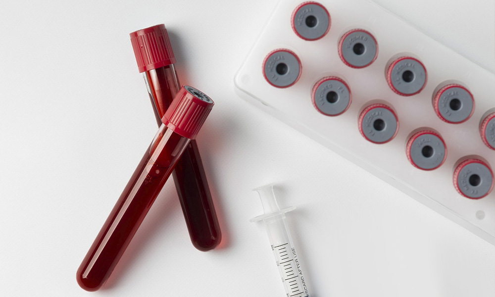 Analíticas de sangre en Farmacia Miramar, en Torredembarra, Tarragona 