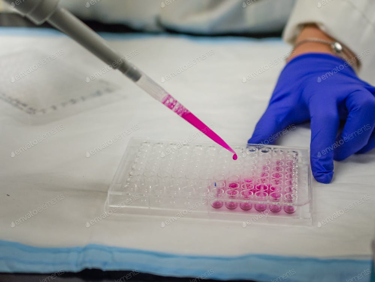 Human tPA(Plasminogen Activator, Tissue) ELISA Kit