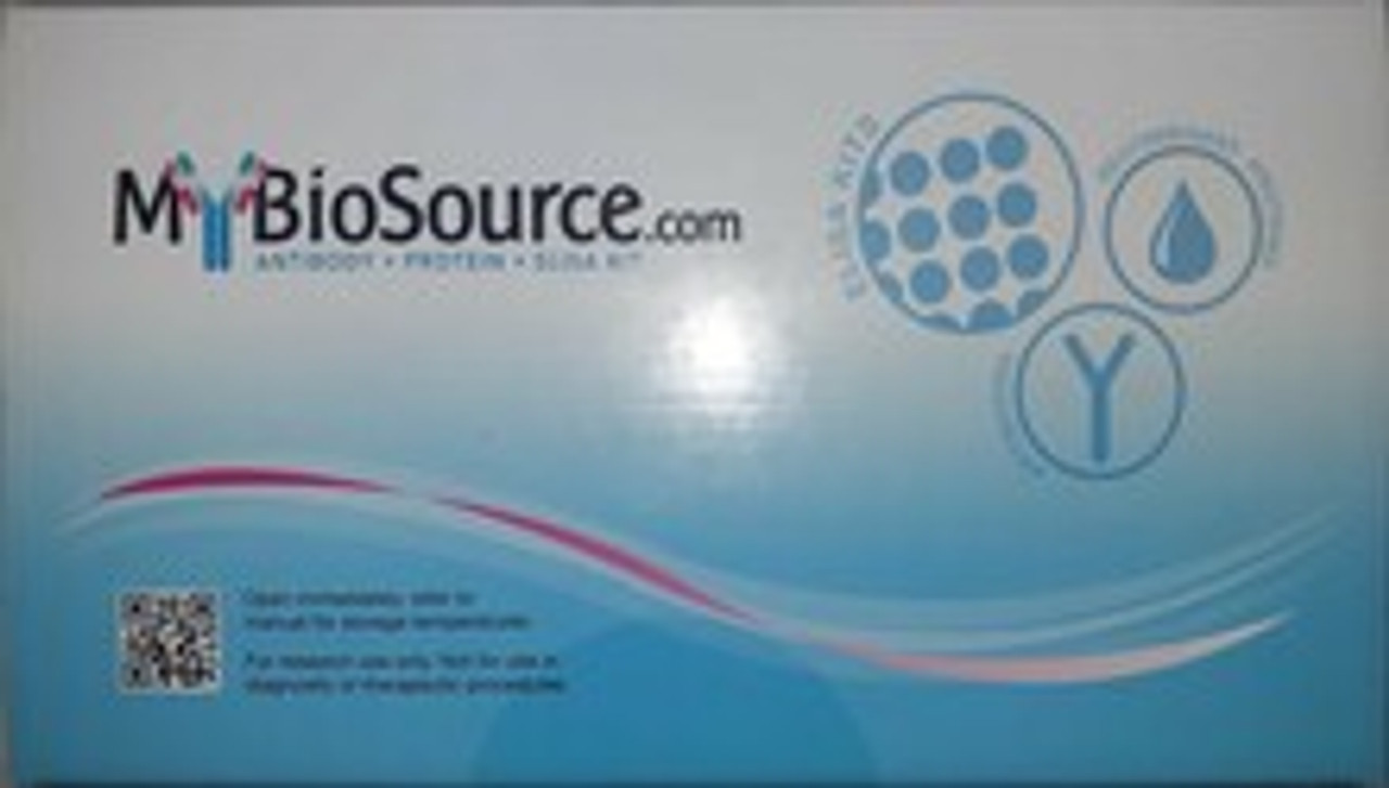 RCN2 (Reticulocalbin 2, Reticulocalbin-2, Calcium-binding Protein ERC-55, E6-binding Protein, E6BP, ERC55)