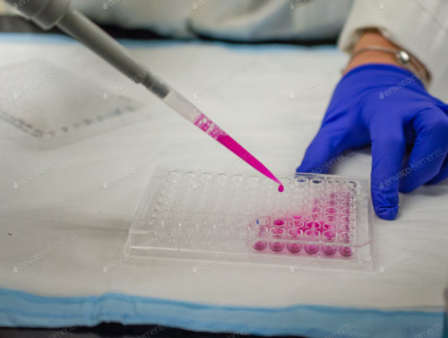 Human TP(Thymidine Phosphorylase) ELISA Kit