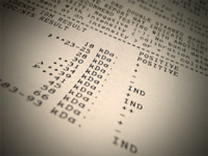How to read your Western Blot Test Results