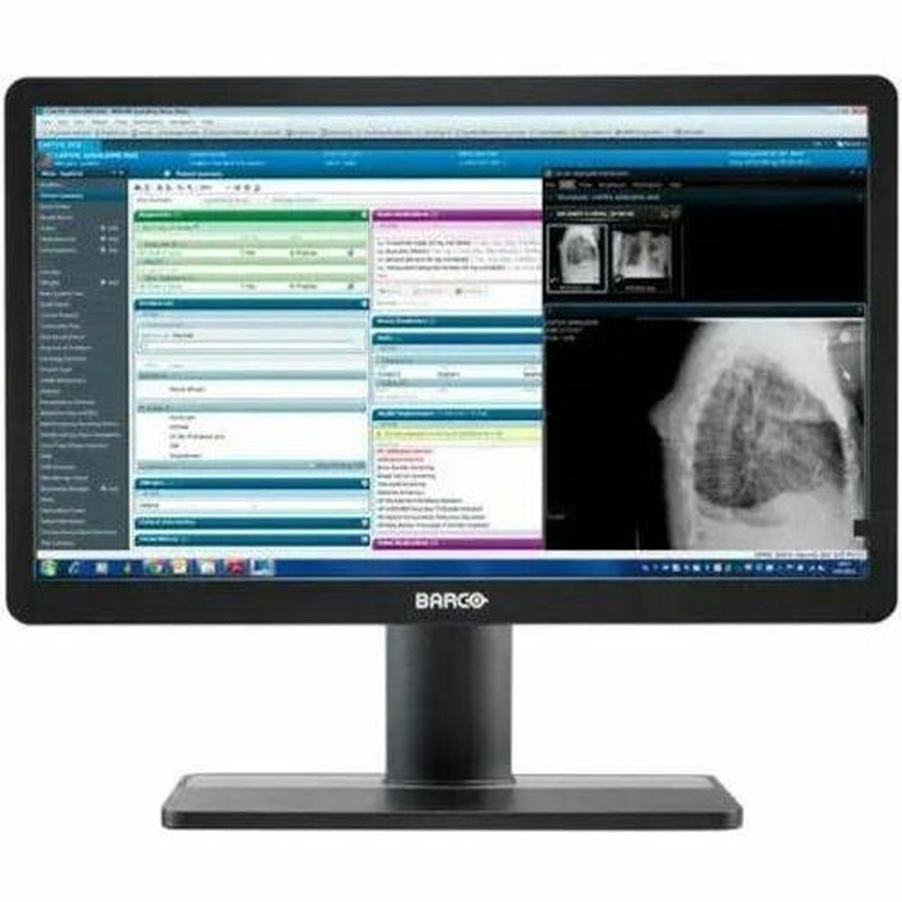 Barco Eonis MDRC-2422 22 Class Full HD LED Monitor - 169 - White - 215 Viewable - Advanced Hyper Viewing Angle AHVA - LED - 1920 K9610942B