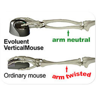 Evoluent_Verticalmouse_Right_Handed_Wireless_-_Optical_-_Wireless_-_Radio_Frequency_-_240_GHz_-_USB_-_Scroll_Wheel_-_6_Buttons_-_VM4RW
