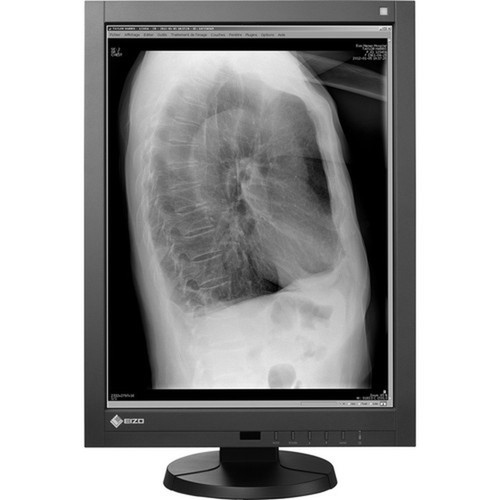 EIZO RadiForce GX240-CL-P UXGA LCD Monitor - 43 - Black - 213 Viewable - LED Backlight - 1600 x 1200 - 1024 Gray Levels - 1200 - 40 GX240-CL-P-BK