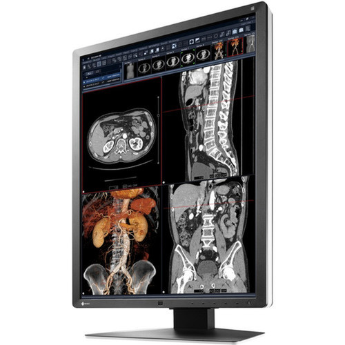 EIZO RadiForce RX250 22 Class LCD Monitor - 34 - Black - 213 Viewable - In-plane Switching IPS Technology - LED Backlight - 1200 RX250-BK