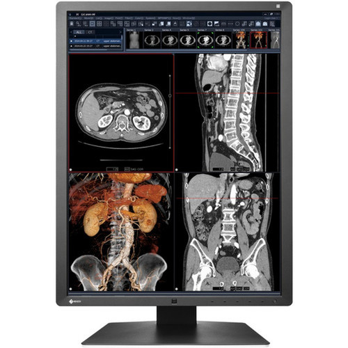 EIZO RadiForce RX250 22 Class LCD Monitor - 34 - Black - 213 Viewable - In-plane Switching IPS Technology - LED Backlight - 1200 RX250-BK