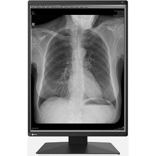 EIZO RadiForce RX250 22 Class LCD Monitor - 34 - Black - 213 Viewable - In-plane Switching IPS Technology - LED Backlight - 1200 RX250-BK
