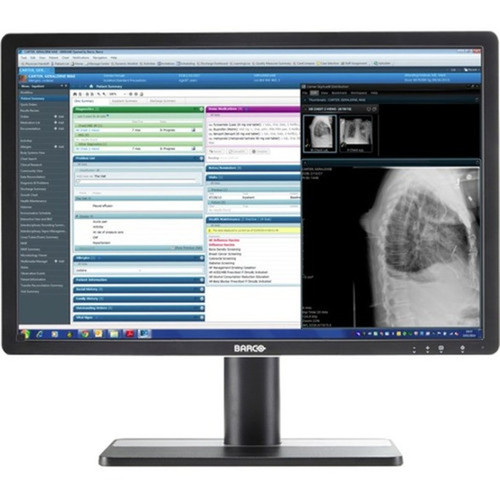 Barco Eonis MDRC-2222 Option TS LCD Touchscreen Monitor - 169 - 750 ms - 215 Viewable - Projected Capacitive - Multi-touch Screen K9307943