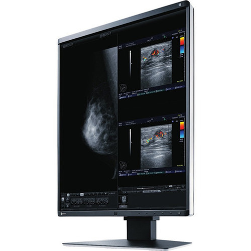 EIZO RadiForce RX560 QXGA LCD Monitor - 43 - Black - 213 Viewable - LED Backlight - 2048 x 2560 - 107 Billion Colors - 1100 - 12 - RX560-BK