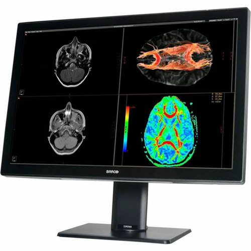 Barco Coronis Fusion MDCC-6530 30 Class WQSXGA LED Monitor - 1610 - Black White - 304 Viewable - In-plane Switching IPS - LED - K9602958