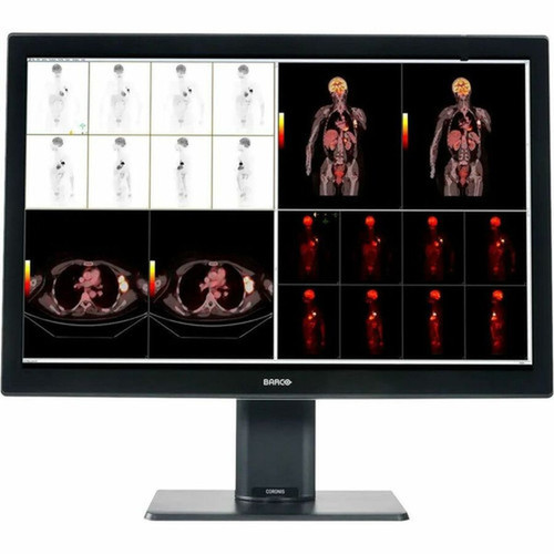 Barco Coronis Fusion MDCC-6530 30 Class WQSXGA LED Monitor - 1610 - Black White - 304 Viewable - In-plane Switching IPS - LED - K9602958