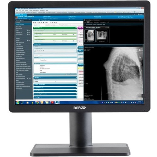 Barco Eonis MDRC-2321 21" Class UXGA LCD Monitor - 4:3 - Black - 21.3" Viewable - LED Backlight - 1600 x 1200 - 1.07 Billion Colors - (Fleet Network)