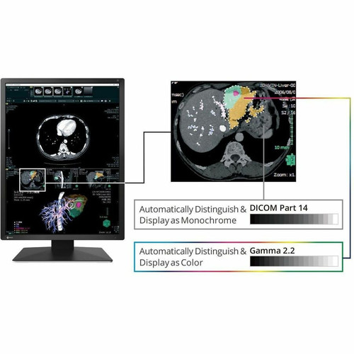 EIZO RadiForce MX217-BK 21" Class UXGA LED Monitor - 3:4 - Black - 21.3" Viewable - In-plane Switching (IPS) Technology - LED - 1200 x (MX217-BK)