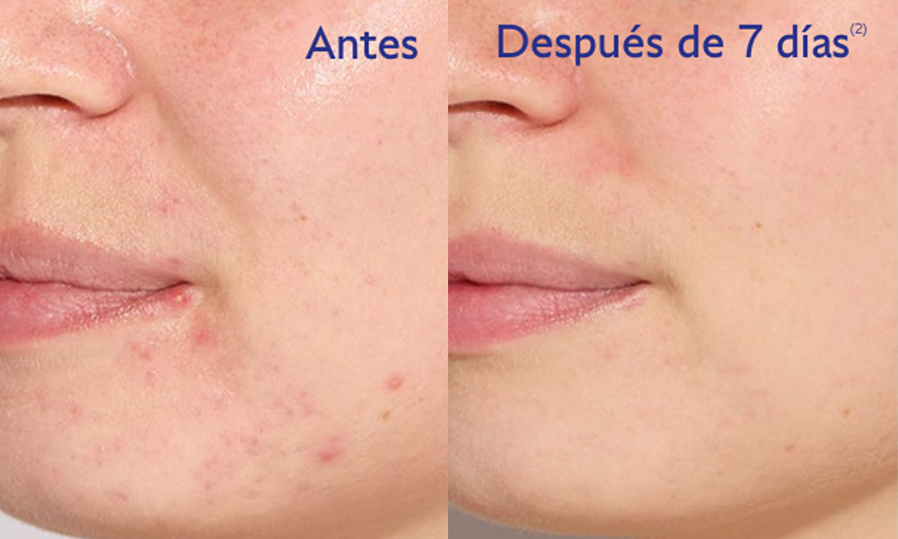 Reducción de sus granos después de 7 días 