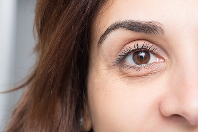 Escape the circle! - Get Rid of Under Eye Dark Circles