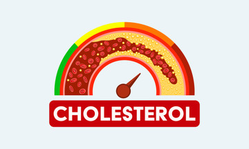 The Link Between High Cholesterol and Nutritional Deficiencies