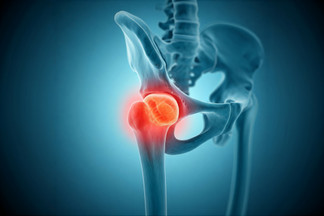 How Nutrition Can Slow Joint Degeneration And Support Chiropractic Therapy