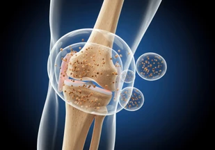 How Nutrition Supports Healthy Synovial Fluid and Joint Function