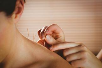 Integrating Chiropractic Care with Massage and Acupuncture for Full-Body Wellness