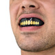 SAFEJAWZ EXTRO SERIES GOLDIE MOUTHGUARD