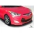 2012-2017 Hyundai Veloster N Design Front Lip - image 3