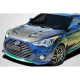 2012-2017 Hyundai Veloster AM-S Carbon Fiber Hood - image 1