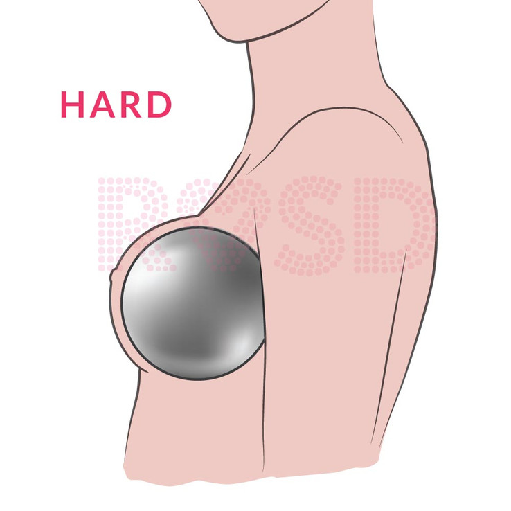 Steel Ball breast fill makes the breast feel hard.
