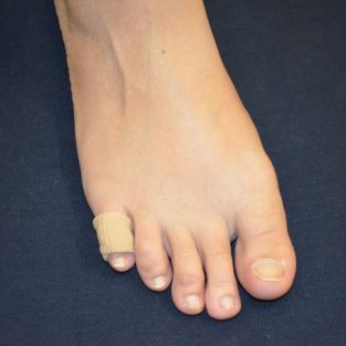 Foot Supply Store Gel Digital Pads