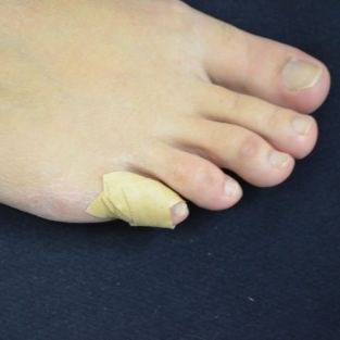 Foot Supply Store Digital Fracture Tape Kit (for broken toes