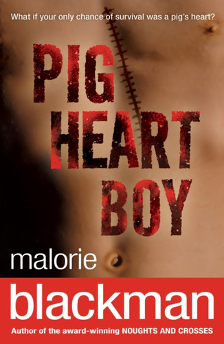 Pig-Heart Boy 9780552551663 Paperback