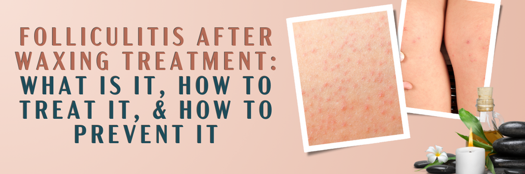 Folliculitis After Waxing Treatment: What is it, How to Treat it, and How to Prevent it?