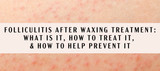 Folliculitis After Waxing Treatment: What is it, How to Treat it, and How to Prevent it?