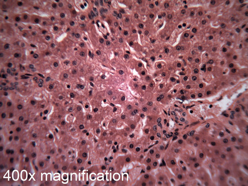 Human liver slide, section