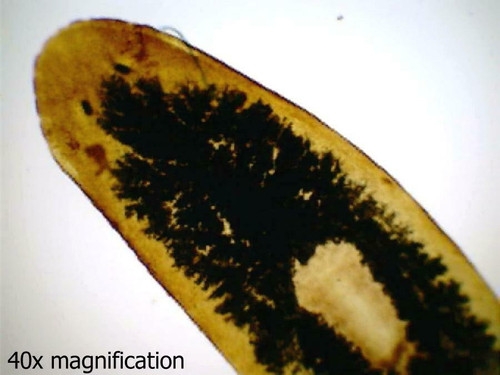 Planaria (flatworm) slide, w.m.