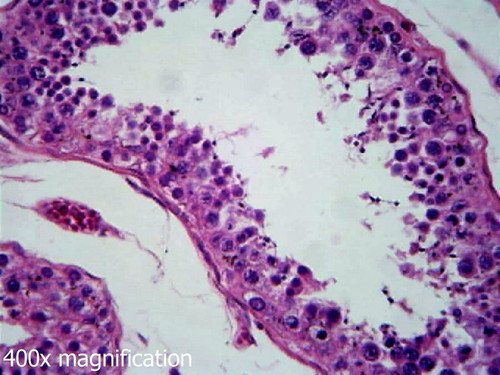 Human testis slide, section