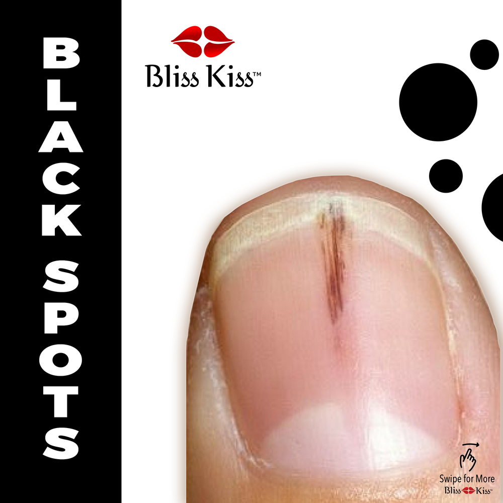 BLISS BLACK —