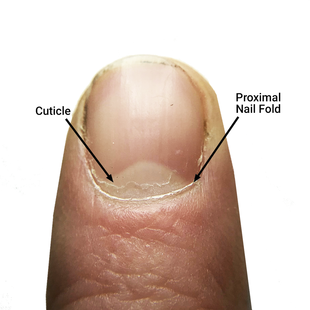 A Comprehensive Guide to Healing Swollen and Peeling Cuticles | Clinikally