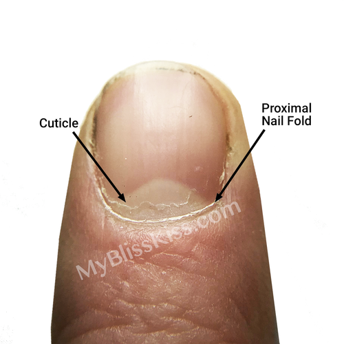 Nail Matrix - Location, Function, Damage and Disorders