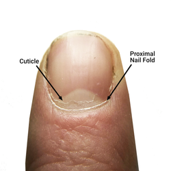 Infection Around Fingernail Cuticle the cuticle should you clip push or scrape