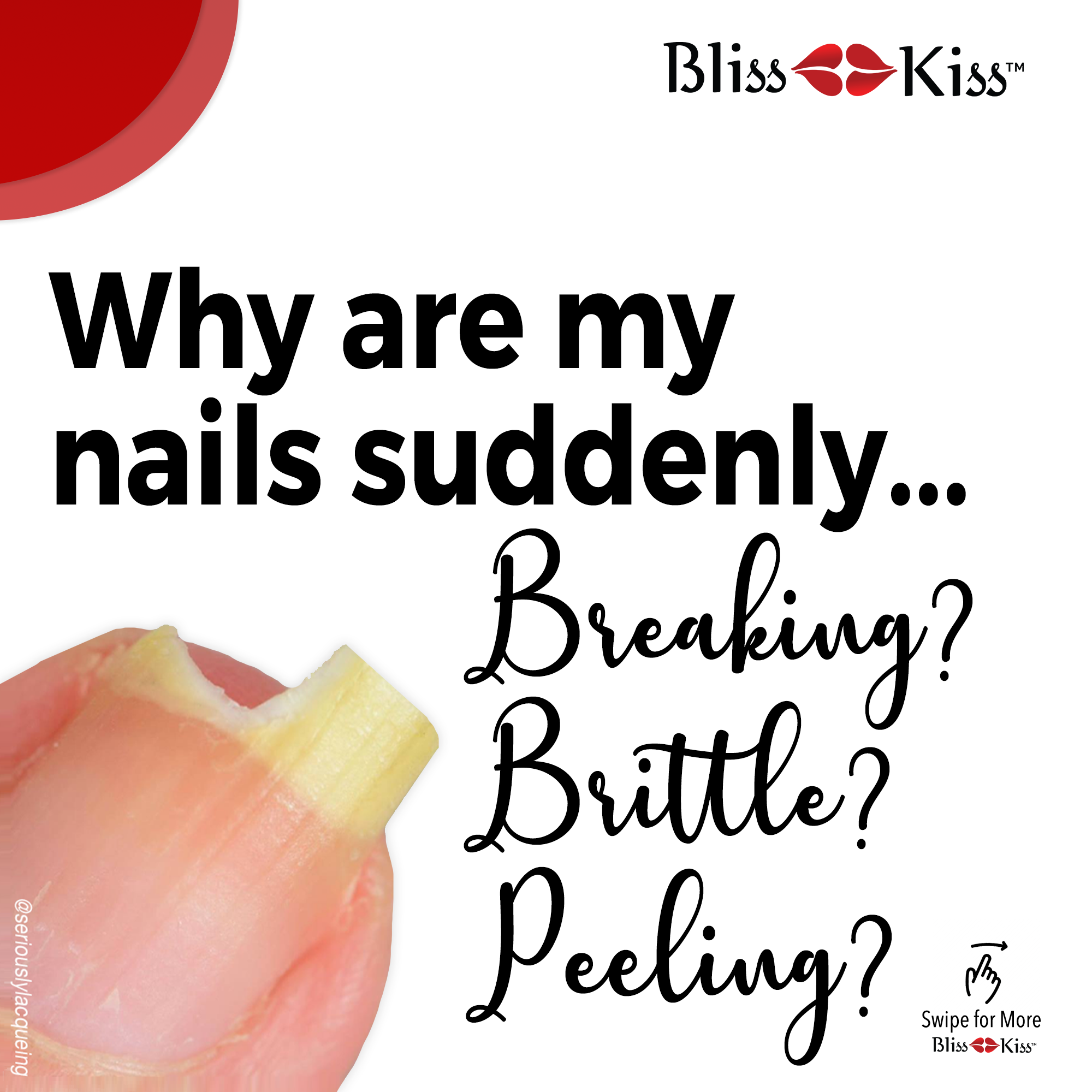 why-are-my-nails-suddenly-breaking-brittle-peeling-bliss-kiss-by