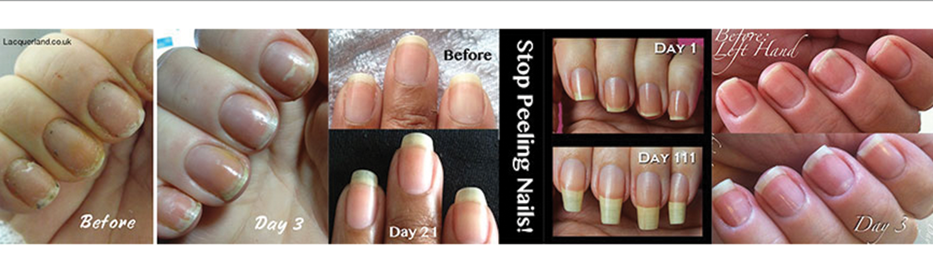 How to Make Your Nails Grow FASTER! - Bliss Kiss by Finely Finished, LLC