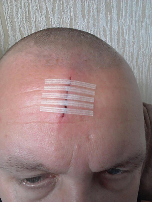 Zafety Adhesive Wound Closure Strips 0.4x3.8cm Packet of 8 Strips Zafety Adhesive Wound Closure Strips 0.4x3.8cm Packet of 8 Strips