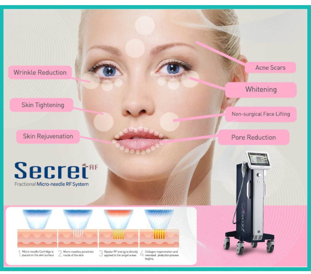 Secret RF