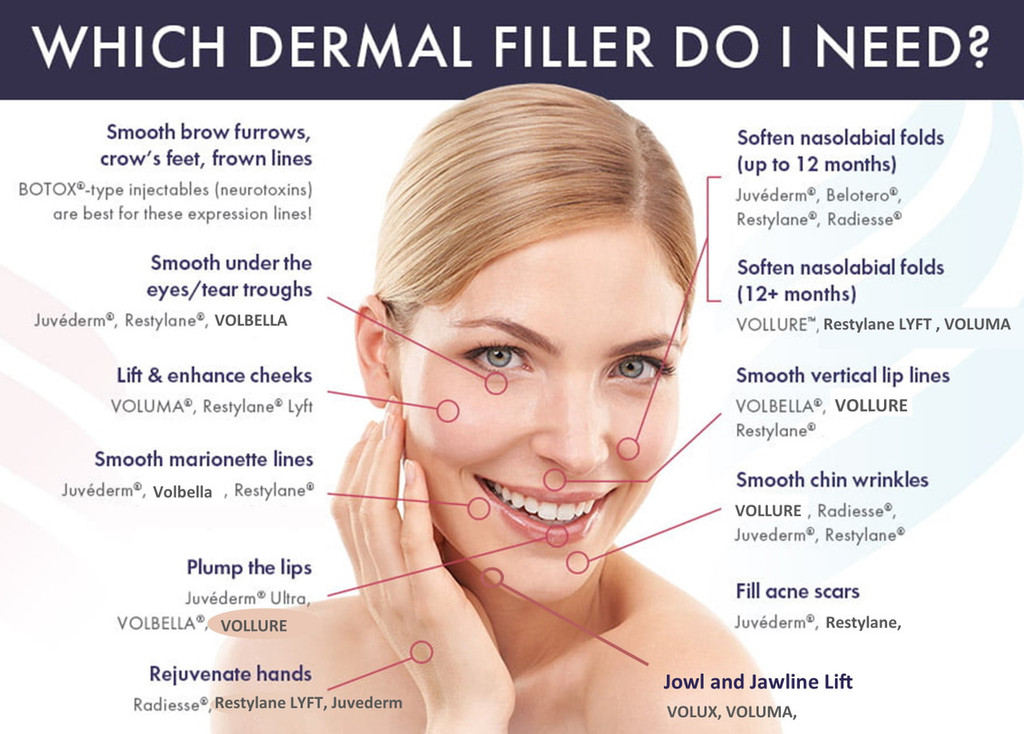 Juvederm Facial Fillers