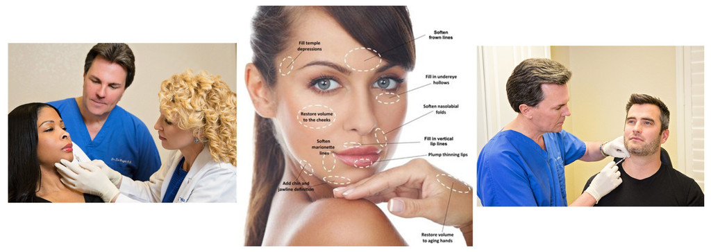 Revance Facial Fillers