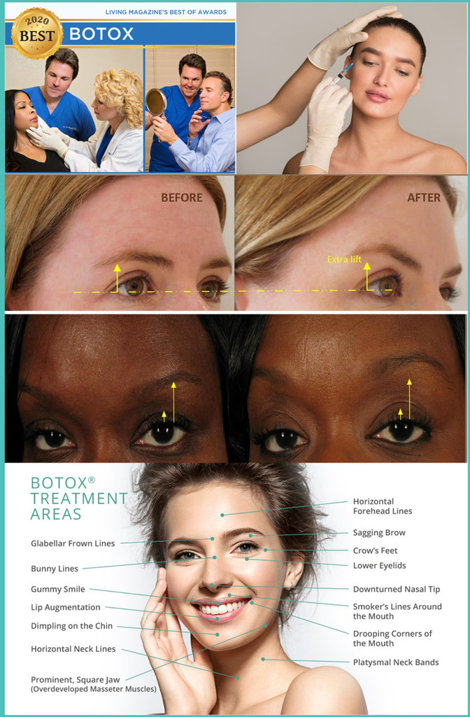 Botox