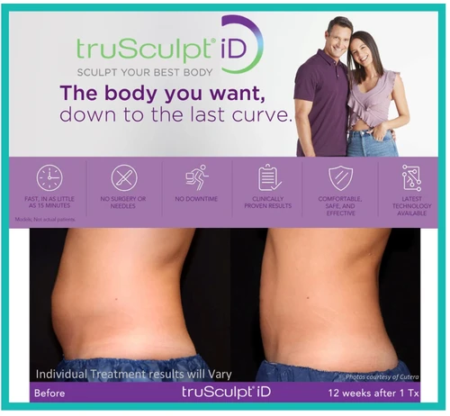 TruSculpt iD