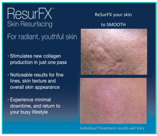 ResurFX