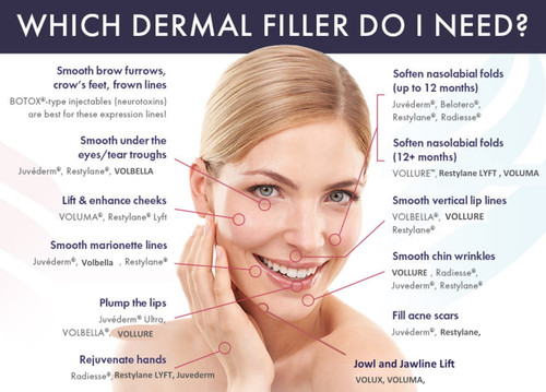 Juvederm Facial Fillers
