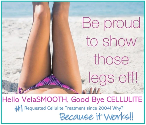 Cellulite Treatments